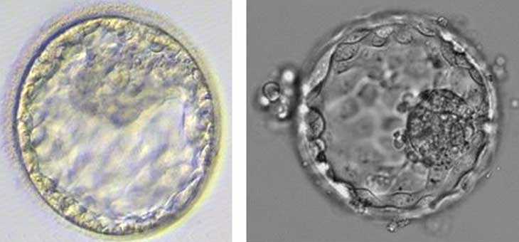 代孕合同文本_试管婴儿胚胎选哪种好？该怎么选择？