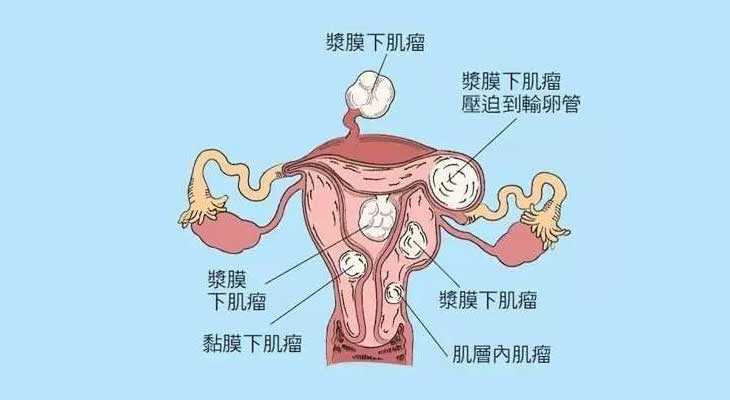 中国的合法供卵_卵巢早衰供卵群,崇左供卵试管,供卵试管费用